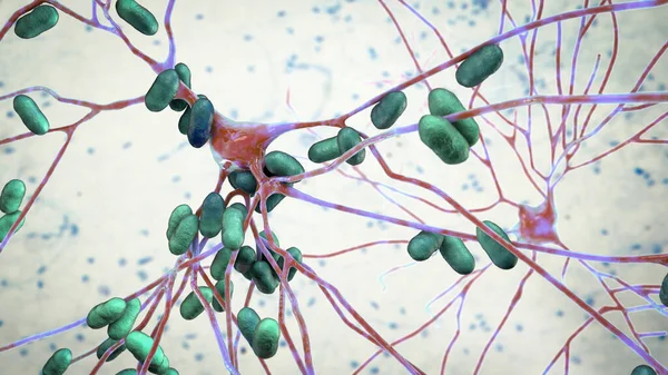 Bakterier Som Infekterar Nervceller Hjärnceller Illustration Konceptuell Illustration Bakteriell Encefalit — Stockfoto