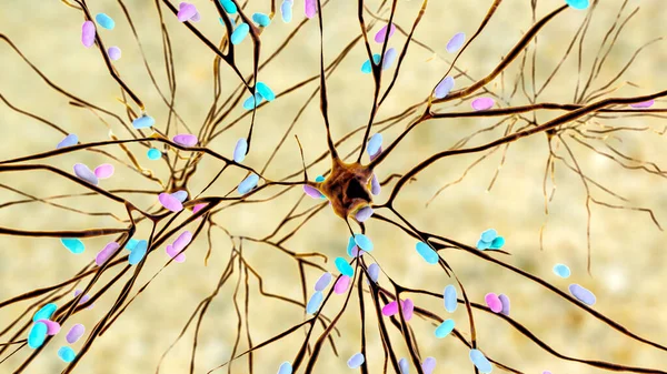 Bacteriën Infecteren Neuronen Hersencellen Illustratie Conceptuele Illustratie Van Bacteriële Encefalitis — Stockfoto