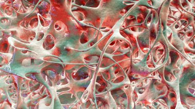 Osteoporotik trabeküler kemik, 3 boyutlu illüstrasyon kemiklerde giderek daha az ve ince trabeküle ve osteoporoz gösteriyor.