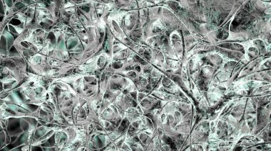 Osteoporotik trabeküler kemik, 3 boyutlu illüstrasyon kemiklerde giderek daha az ve ince trabeküle ve osteoporoz gösteriyor.