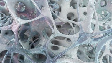 Osteoporotik trabeküler kemik, 3 boyutlu illüstrasyon kemiklerde giderek daha az ve ince trabeküle ve osteoporoz gösteriyor.