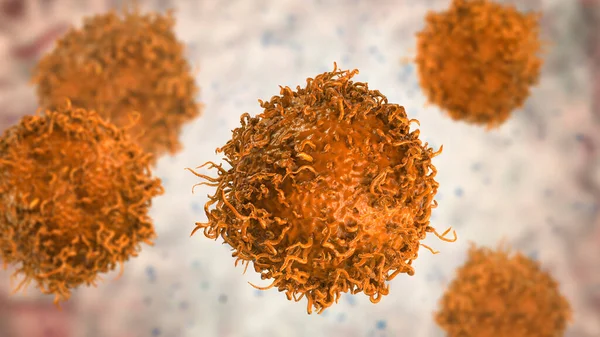 Células Cancerosas Estómago Ilustración Que Muestra Morfología Células Cancerosas —  Fotos de Stock