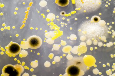 Petri kabında yetişen farklı bakteri ve mantar kolonileri. Mikrobiyoloji arka planı