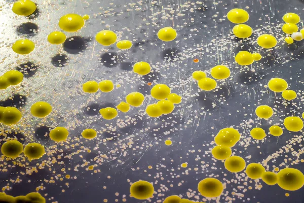 Bakterie Wyhodowane Rozmazu Skóry Kolonii Micrococcus Luteus Staphylococcus Epidermidis Płytce — Zdjęcie stockowe