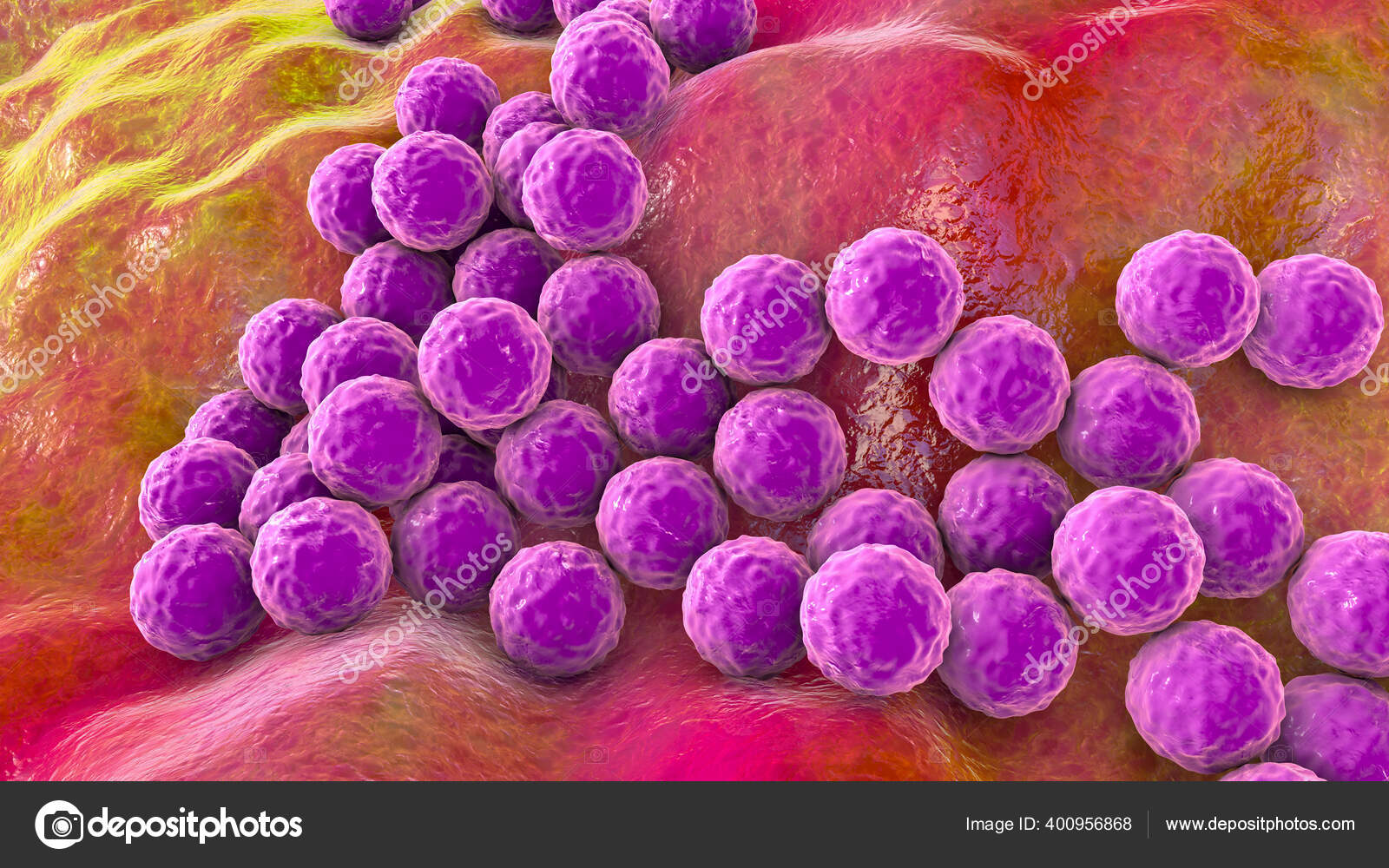 staphylococcus epidermis epidermidi