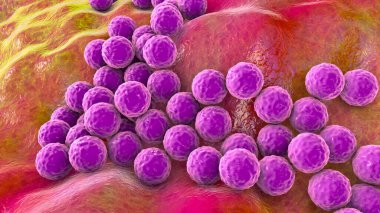 Bakteri Staphylococcus aureus, Staphylococcus epidermidis, MRSA, ilaca dirençli bakteri, 3D çizim