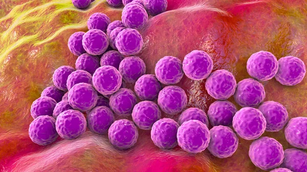 Baktériumok Staphylococcus Aureus Staphylococcus Epidermidis Mrsa Multidrug Rezisztens Baktériumok Illusztráció — Stock Fotó