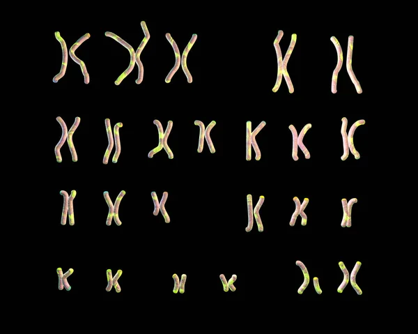 Karyotype Angelman Syndrome Illustration Trastorno Genético Causado Por Falta Función — Foto de Stock