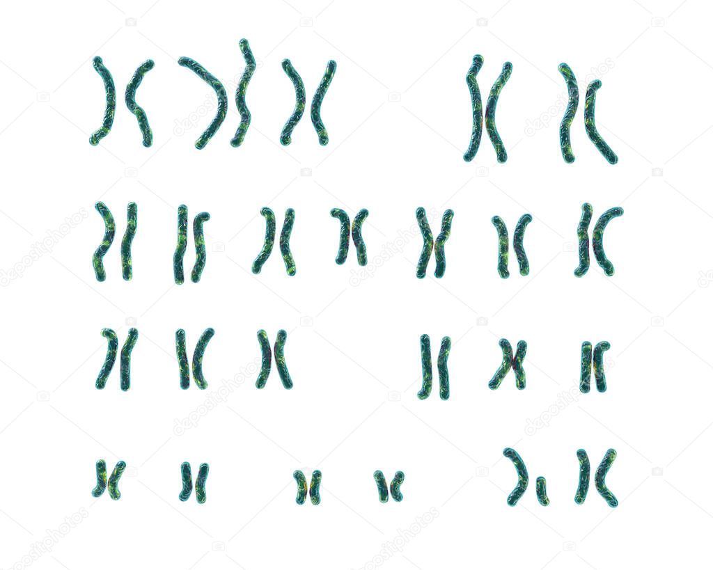 Karyotype of Cri du chat, or cat's cry, syndrome, 3D illustration. A rare genetic disorder caused by a partial chromosome deletion on chromosome 5. Also known as 5p- and Lejeune's syndrome