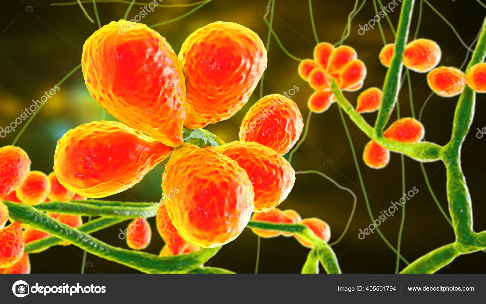 Champignon Sporothrix Schenckii L'agent Causal Sporotrichose  Particulièrement Fréquent Chez Les — Photo de stock par ©katerynakon -  405501794, image size:1600x1000