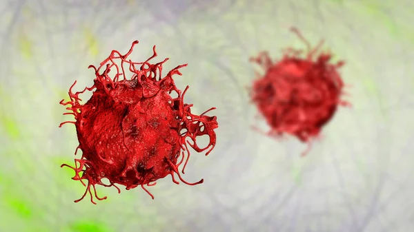 Skin cancer cells, 3D illustration