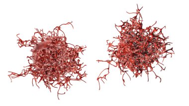 Cervical cancer cells, 3D illustration. Malignant tumor of cervix uteri clipart