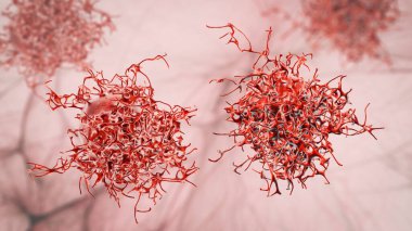 Rahim ağzı kanseri hücreleri, 3 boyutlu çizimler. Rahmin kötü huylu tümörü.