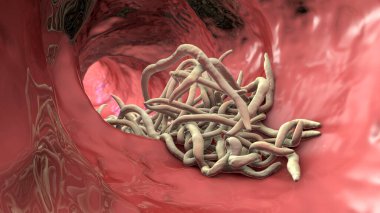 Parasitic worms in the lumen of intestine, 3D illustration. Ascaris lumbricoides and other round worms clipart