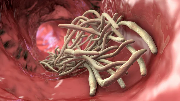 Parasitic worms in the lumen of intestine, 3D illustration. Ascaris lumbricoides and other round worms