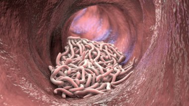 Bağırsak lümeninde parazit solucanlar, 3 boyutlu çizimler. Ascaris lumbrikoides, Enterobius vermicularis ve diğer yuvarlak solucanlar.