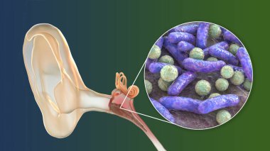 Otitis medyası, orta kulağın iltihaplı hastalığı, ve bakteriye yakından bakma, otitin nedensel faktörü, 3 boyutlu illüstrasyon