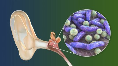 Otitis media, an inflammatory disease of the middle ear, and close-up view of bacteria, the causative agent of otitis, 3D illustration clipart