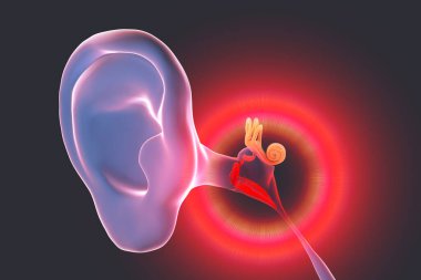 Otitis media, bir grup iltihaplı orta kulak hastalığı, 3 boyutlu illüstrasyon