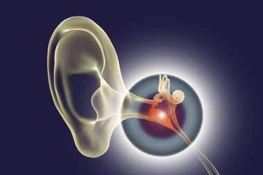 Otitis media, bir grup iltihaplı orta kulak hastalığı, 3 boyutlu illüstrasyon