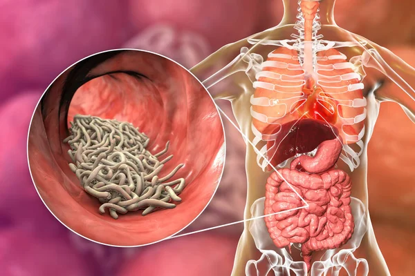 Vers Parasites Dans Intestin Humain Illustration Ascaris Lumbricoides Autres Vers — Photo