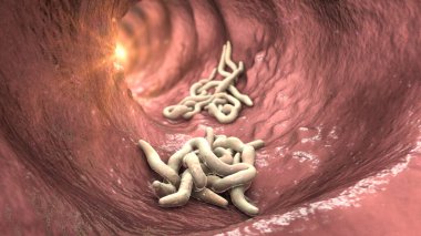 Bağırsak lümeninde parazit solucanlar, 3 boyutlu çizimler. Ascaris lumbrikoides, Enterobius vermicularis ve diğer yuvarlak solucanlar.
