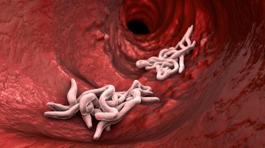 Bağırsak lümeninde parazit solucanlar, 3 boyutlu çizimler. Ascaris lumbrikoides, Enterobius vermicularis ve diğer yuvarlak solucanlar.