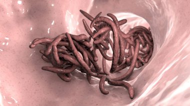 Bağırsak lümeninde parazit solucanlar, 3 boyutlu çizimler. Ascaris lumbrikoides, Enterobius vermicularis ve diğer yuvarlak solucanlar.