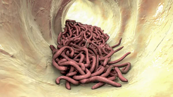 肠道腔中的寄生蠕虫 3D插图 刺五加 线虫和其他圆虫 — 图库照片