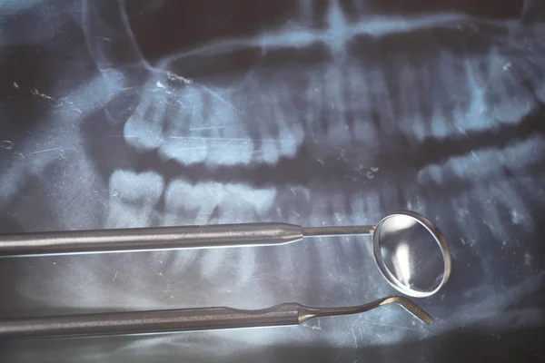 Крупним планом рентген зубів і зубних інструментів — стокове фото