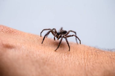 kişi kol üzerinde zehirli örümcek, zehirli örümcek ısırma kişi, araknofobi kavramı, örümcek korkusu. Örümcek Isırığı.