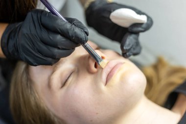 Kalıcı makyaj işleminden önce dudak hazırlama.