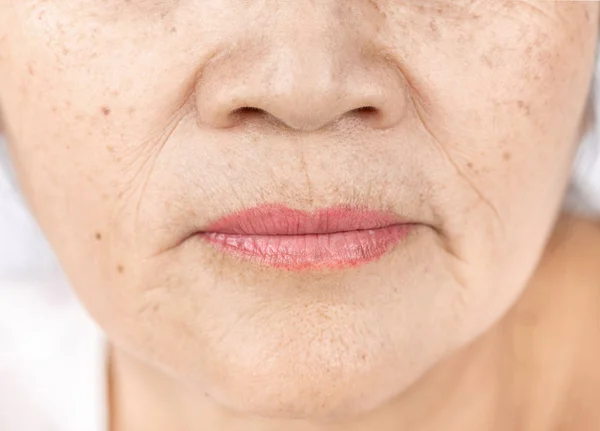 Arrugas Pecas Línea Piel Primer Plano Anciano Mujer Asiática Cara — Foto de Stock