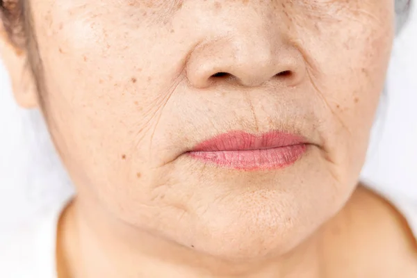 Rugas Sardas Linha Pele Close Idosos Asiático Mulher Rosto Anos — Fotografia de Stock