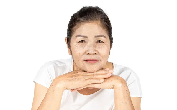 Elderly Asian Woman Wrinkle Freckle Face Include White Clothes Black — Stock Photo, Image