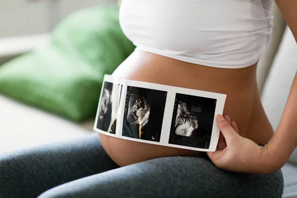 Mujer Embarazada Sosteniendo Foto Ultrasonido Vientre — Foto de Stock
