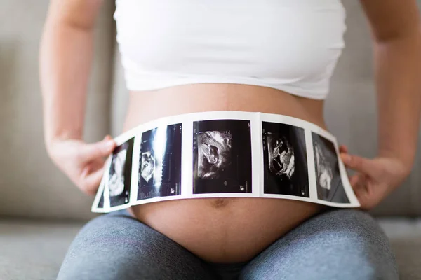 Mujer Embarazada Sosteniendo Foto Ultrasonido Vientre — Foto de Stock