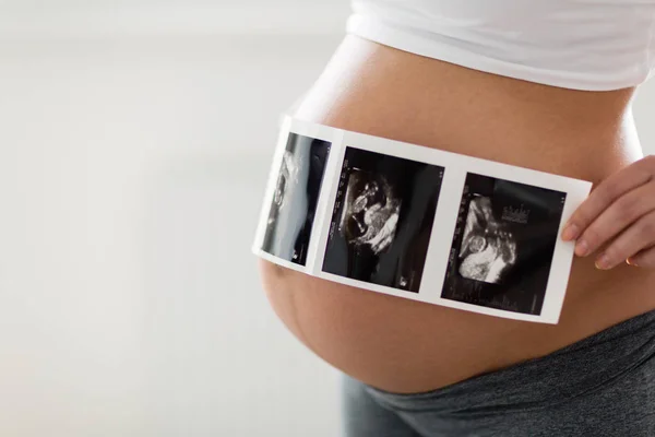 Wanita Hamil Memegang Ultrasound Foto Perut — Stok Foto