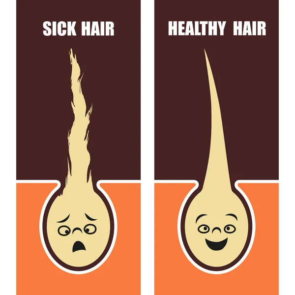 Medical Educational Poster Sick Healthy Hair Vector Illustration — Stock Vector