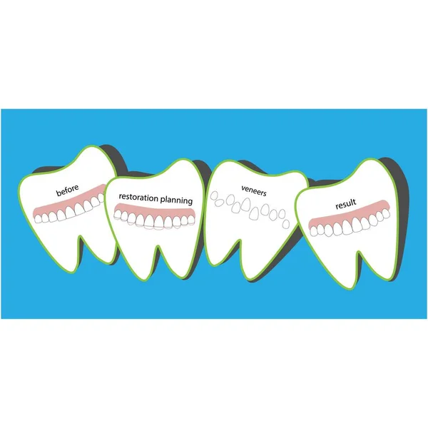 Chapas de odontología, gran diseño para cualquier propósito . — Vector de stock