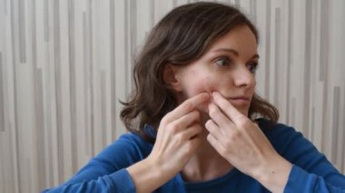 Yüzünde güzel esmer kız presler akne