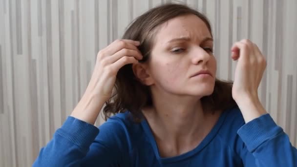 Menina Morena Bonita Pressiona Acne Seu Rosto — Vídeo de Stock