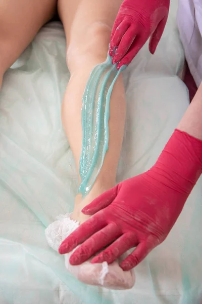 Proces depilacji cukrem. Mistrz w rękawicach medycznych stawia — Zdjęcie stockowe