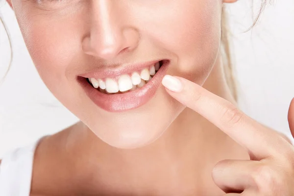 Красива Усміхнена Жінка Показує Білі Зуби Концепція Стоматології — стокове фото