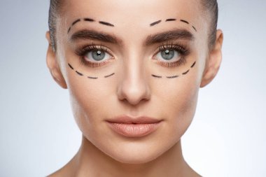 Genç kadın, estetik ameliyat kavramı güzellik portresi. Yüzündeki ponksiyon çizgilerle model