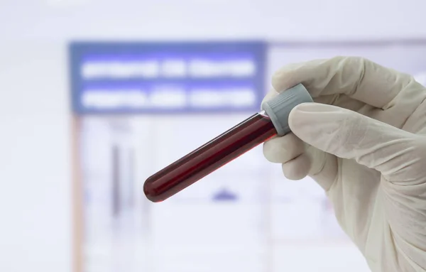 Blood sample — Stock Photo, Image