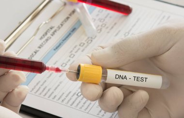 DNA testi