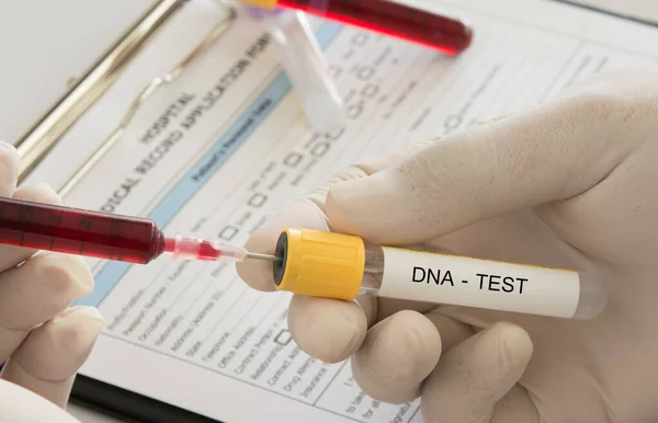 DNA testi — Stok fotoğraf