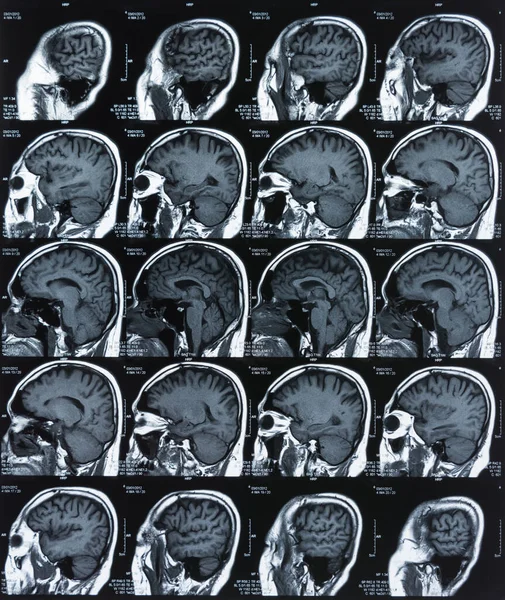 x-ray film image of brain by mri, ct scan for medical diagnosis ...