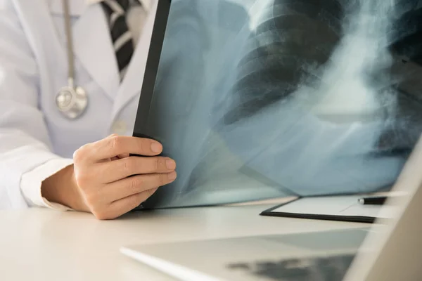 Doctor Examining Lungs Radiograph Ray Film Patient Roentgen Room — Stock Photo, Image